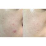 آمپول ترمیم کننده و ضدچروک بیفیدابیوم منیوفکتوری - Image 8