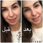 بی بی کرم مجیک حلزون آینپیور - Image 5