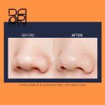 ماسک سه مرحله ای پاکسازی جوش سرسیاه بینی اپیو - Image 7