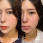 پاک کننده آمپولی آبرسان ناین ویشز - Image 9