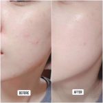 تونر ضدلک و روشن کننده سنتلا ماداگاسکار اسکین ۱۰۰۴ - Image 2