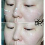 ضدآفتاب واتری آب اکسیژنه محبوب شینگمول نارا - Image 9