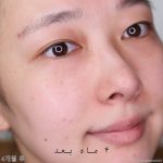 کرم دور چشم روشن کننده قوی و جوانساز برند باکیفیت BIO HEAL BOH - Image 9