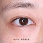 کرم دور چشم روشن کننده قوی و جوانساز برند باکیفیت BIO HEAL BOH - Image 8