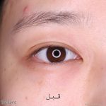 کرم دور چشم روشن کننده قوی و جوانساز برند باکیفیت BIO HEAL BOH - Image 7