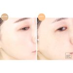 فوم شستشو نانو بابل ضدحساسیت و پاکسازی منافذ Dr.Banggiwon - Image 6