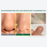 روغن پاک کننده صورت و منافذ ضدجوش و ضدالتهاب Anua - Image 3