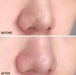 ماسک استیکی فوری جمع کننده منافذ سنتلا اسکین1004 - Image 4
