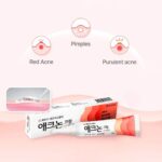 کرم ضدجوش تخصصی و ضدالتهاب Acnon Cream Spot Treatment for Red & Purulent Acne - Image 5