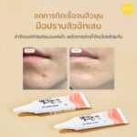 کرم ضدجوش تخصصی و ضدالتهاب Acnon Cream Spot Treatment for Red & Purulent Acne - Image 4
