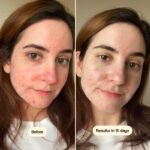 سرم شفاف کننده و ضدقرمزی آزلائیک اسید ۱۰٪ NINELESS - Image 4