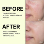 سرم رتینال ضدچروک و سفت کننده و قابض منافذ celimax - Image 4
